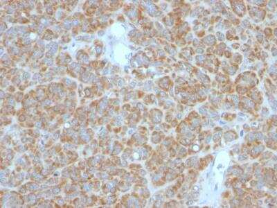 Immunohistochemistry-Paraffin: Bcl-2 Antibody (BCL2/782 + BCL2/796) - IHC-Prediluted [NBP2-48303]