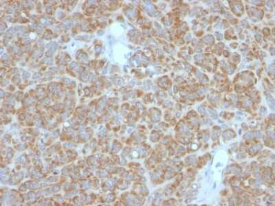 Immunohistochemistry-Paraffin: Bcl-2 Antibody (BCL2/782 + BCL2/796) [NBP2-44785]