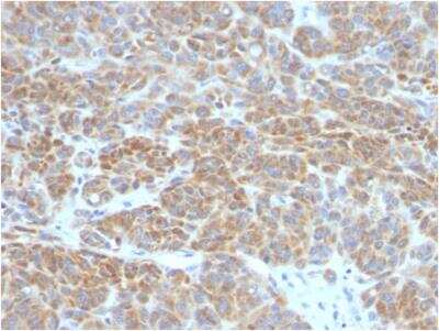 Immunohistochemistry-Paraffin: Bcl-2 Antibody (BCL2/782) - Azide and BSA Free [NBP2-47851]