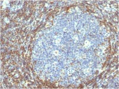 Immunohistochemistry-Paraffin: Bcl-2 Antibody (BCL2/782) - IHC-Prediluted [NBP2-48277]