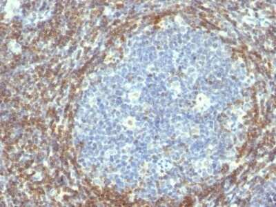 Immunohistochemistry-Paraffin: Bcl-2 Antibody (BCL2/782) [NBP2-44783]