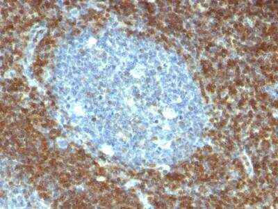 Immunohistochemistry-Paraffin: Bcl-2 Antibody (BCL2/796) - Azide and BSA Free [NBP2-47852]