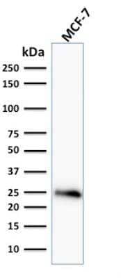 Western Blot: Bcl-2 Antibody (BCL2/796)Azide and BSA Free [NBP2-47852]