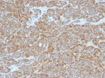 Immunohistochemistry-Paraffin: Bcl-2 Antibody (BCL2/796) - IHC-Prediluted [NBP2-48278]