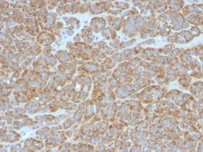 Immunohistochemistry-Paraffin: Bcl-2 Antibody (BCL2/796) [NBP2-44784]