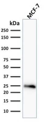 Western Blot: Bcl-2 Antibody (BCL2/796) [NBP2-44784]