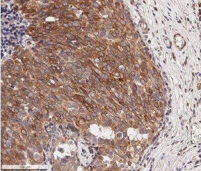 Immunohistochemistry-Paraffin: Bcl-2 Antibody [NB100-56098]