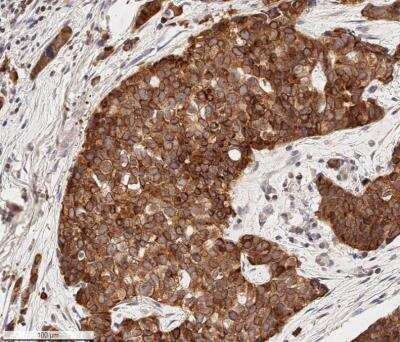 Immunohistochemistry-Paraffin: Bcl-2 Antibody [NB100-56098]
