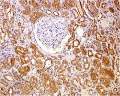 Immunohistochemistry-Paraffin: Bcl-2 Antibody - BSA Free [NBP2-30108]