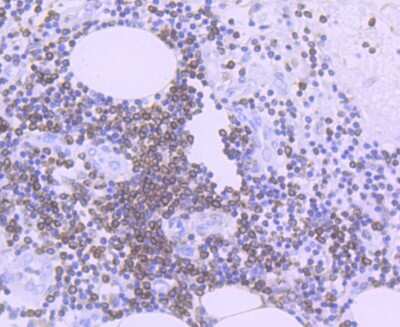 Immunohistochemistry-Paraffin: Bcl-2 Antibody (JF104-8) [NBP2-67182]