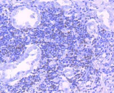 Immunohistochemistry-Paraffin: Bcl-2 Antibody (JF104-8) [NBP2-67182]