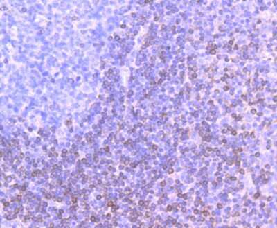 Immunohistochemistry-Paraffin: Bcl-2 Antibody (JF104-8) [NBP2-67182]