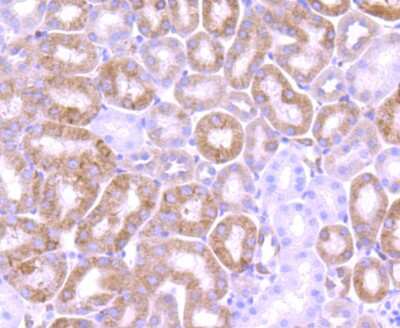 Immunohistochemistry-Paraffin: Bcl-2 Antibody (JF104-8) [NBP2-67182]