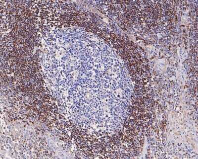 Immunohistochemistry-Paraffin: Bcl-2 Antibody (JF104-8) [NBP2-67182]