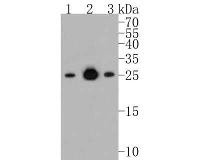 Western Blot: Bcl-2 Antibody (JF104-8) [NBP2-67182]