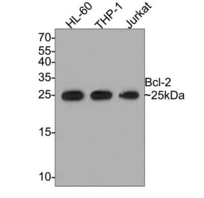 Western Blot: Bcl-2 Antibody (JF104-8) [NBP2-67182]