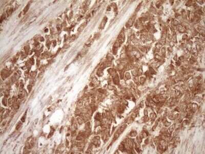 Immunohistochemistry: Bcl-2 Antibody (OTI9D3) - Azide and BSA Free [NBP2-70245]