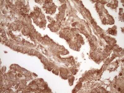 Immunohistochemistry: Bcl-2 Antibody (OTI9D3) - Azide and BSA Free [NBP2-70245]