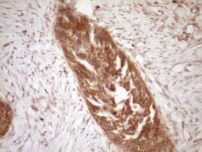 Immunohistochemistry: Bcl-2 Antibody (OTI9D3) - Azide and BSA Free [NBP2-70245]