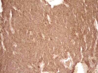 Immunohistochemistry: Bcl-2 Antibody (OTI9D3) - Azide and BSA Free [NBP2-70245]