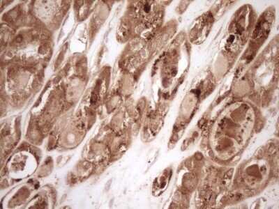 Immunohistochemistry: Bcl-2 Antibody (OTI9D3) - Azide and BSA Free [NBP2-70245]