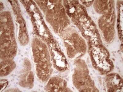Immunohistochemistry: Bcl-2 Antibody (OTI9D3) - Azide and BSA Free [NBP2-70245]