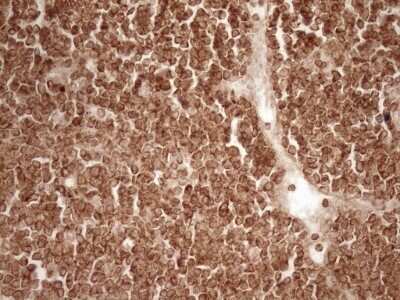 Immunohistochemistry: Bcl-2 Antibody (OTI9D3) - Azide and BSA Free [NBP2-70245]