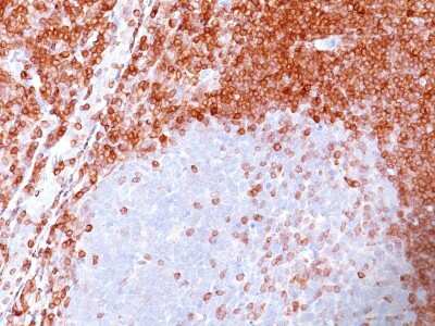 Immunohistochemistry-Paraffin: Bcl-2 Antibody (SPM117) [NBP2-34391]
