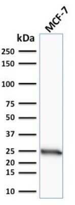 Western Blot: Bcl-2 Antibody (SPM117) [NBP2-34391]