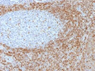Immunohistochemistry-Paraffin: Bcl-2 Antibody (SPM530) [NBP2-34389]