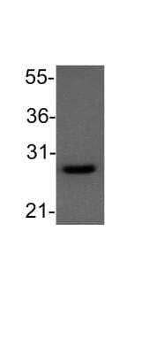 Western Blot: Bcl-2 Antibody [NB100-56098]