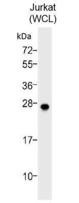 Western Blot: Bcl-2 Antibody [NB100-56098]