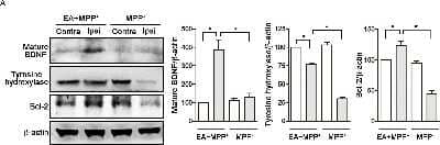 Western Blot: Bcl-2 Antibody [NB100-56098]