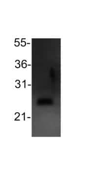 Western Blot: Bcl-2 Antibody [NB100-56101]