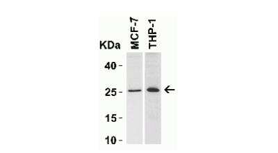Western Blot: Bcl-2 AntibodyBSA Free [NBP2-30108]