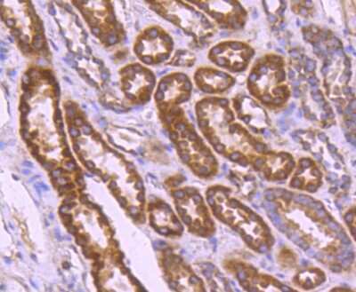 Immunohistochemistry-Paraffin: Bcl-2 related protein A1 Antibody (SC05-42) [NBP2-67563]