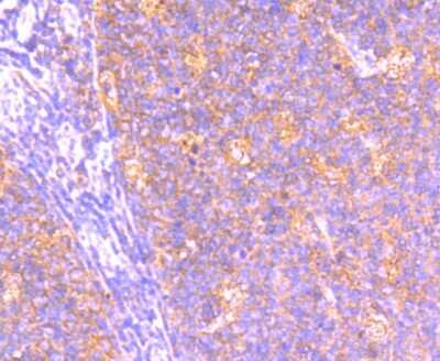 Immunohistochemistry-Paraffin: Bcl-2 related protein A1 Antibody (SC05-42) [NBP2-67563]