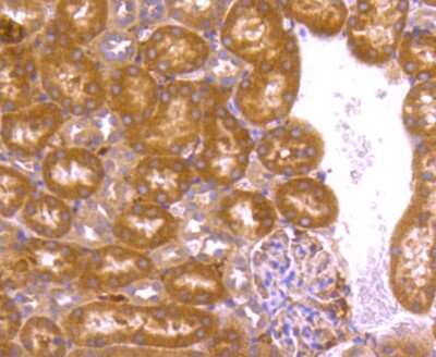 Immunohistochemistry-Paraffin: Bcl-2 related protein A1 Antibody (SC05-42) [NBP2-67563]