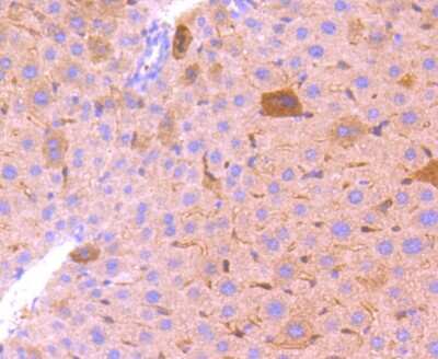Immunohistochemistry-Paraffin: Bcl-2 related protein A1 Antibody (SC05-42) [NBP2-67563]