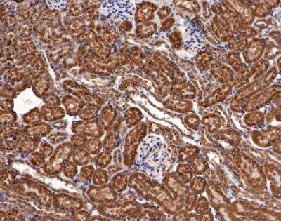 Immunohistochemistry-Paraffin: Bcl-2 related protein A1 Antibody (SC05-42) [NBP2-67563]