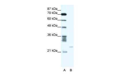 Western Blot: Bcl-2 related protein A1 Antibody [NBP3-10872]