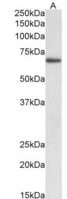 Western Blot: Bcl-6 Antibody (BCL6/1475)Azide and BSA Free [NBP2-59597]