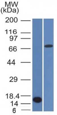 Western Blot: Bcl-6 Antibody (BCL6/1475)Azide and BSA Free [NBP2-59597]