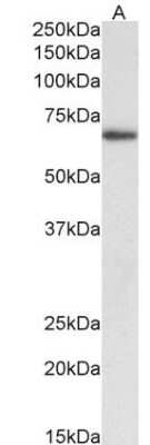 Western Blot: Bcl-6 Antibody (BCL6/1475) [NBP2-59596]