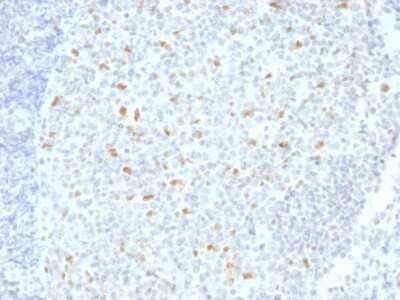 Immunohistochemistry-Paraffin: Bcl-6 Antibody (BCL6/1526) [NBP3-07527]