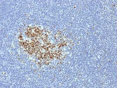 Immunohistochemistry-Paraffin: Bcl-6 Antibody (BCL6/1718) [NBP3-07540]