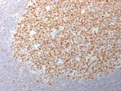 Immunohistochemistry-Paraffin: Bcl-6 Antibody (BCL6/1982) - Azide and BSA Free [NBP2-75749]