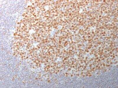 Immunohistochemistry-Paraffin: Bcl-6 Antibody (BCL6/1982) [NBP2-75748]