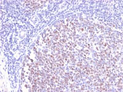 Immunohistochemistry-Paraffin: Bcl-6 Antibody (BCL6/2497R) - Azide and BSA Free [NBP3-08313]