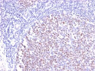 Immunohistochemistry-Paraffin: Bcl-6 Antibody (BCL6/2497R) [NBP3-07563]